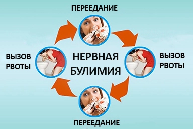 Лечение булимии в Бессоновке